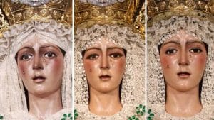 Diferentes expresiones de la Macarena tras la intervención de Arquillo.