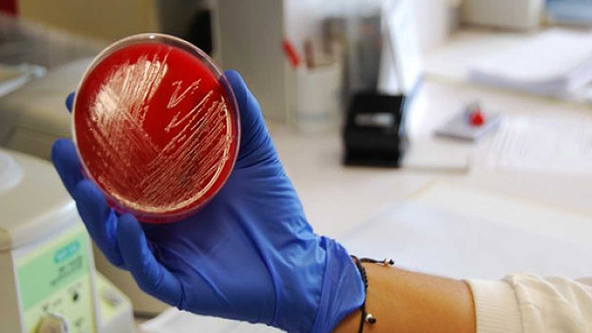 Alerta sanitaria en Sevilla por un lote cárnico con listeria