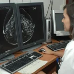 CSIF acusa al SAS de negligencia en el cribado de cáncer de mama, piden plazos legales inmediatos