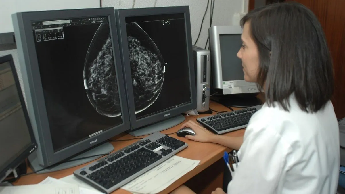 Médica mirando en pantalla una mamografía.